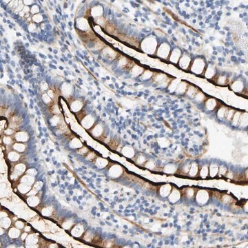 Anti-SLC30A7 antibody produced in rabbit Prestige Antibodies&#174; Powered by Atlas Antibodies, affinity isolated antibody, buffered aqueous glycerol solution