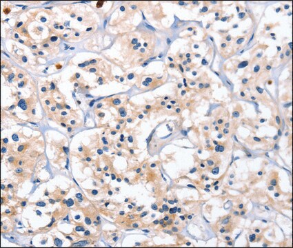 Anti-CATSPER1 antibody produced in rabbit affinity isolated antibody