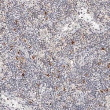 Anti-PARP10 antibody produced in rabbit Prestige Antibodies&#174; Powered by Atlas Antibodies, affinity isolated antibody, buffered aqueous glycerol solution