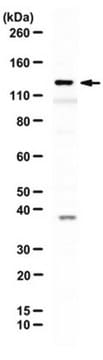 Anti-RecQ5 Antibody serum, from rabbit