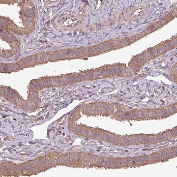 Anti-PLEKHM1 antibody produced in rabbit Prestige Antibodies&#174; Powered by Atlas Antibodies, affinity isolated antibody, buffered aqueous glycerol solution