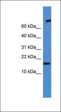 Anti-FGF1 antibody produced in rabbit affinity isolated antibody