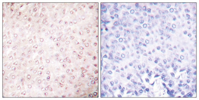 Anti-p300 antibody produced in rabbit affinity isolated antibody