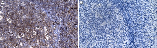 Anti-CD40 Antibody, clone 2E20 ZooMAb&#174; Rabbit Monoclonal recombinant, expressed in HEK 293 cells