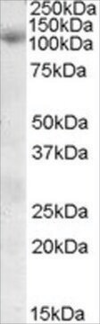 Anti-SNX19 antibody produced in goat affinity isolated antibody, buffered aqueous solution