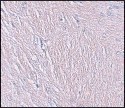 Anti-SYNPO antibody produced in rabbit affinity isolated antibody, buffered aqueous solution