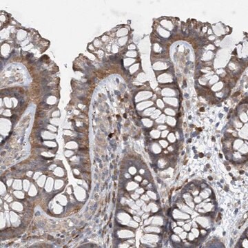 Anti-N4BP2 antibody produced in rabbit Prestige Antibodies&#174; Powered by Atlas Antibodies, affinity isolated antibody, buffered aqueous glycerol solution