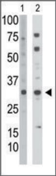 Anti-TK2 (C-term) antibody produced in rabbit IgG fraction of antiserum, buffered aqueous solution