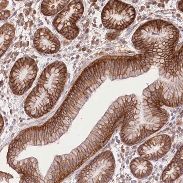 Anti-XYLB antibody produced in rabbit Prestige Antibodies&#174; Powered by Atlas Antibodies, affinity isolated antibody, buffered aqueous glycerol solution