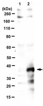 Anti-Adenovirus 5 L4-33K