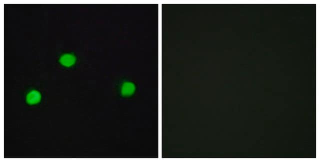 Anti-IP6K2 antibody produced in rabbit affinity isolated antibody