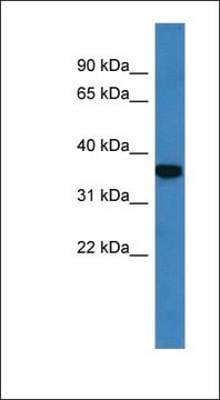 Anti-DECR2 antibody produced in rabbit affinity isolated antibody