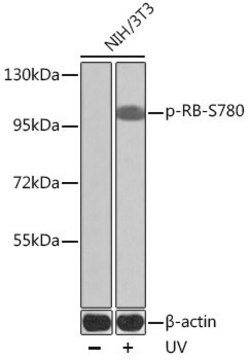 Anti-Phospho-RB-S780 antibody produced in rabbit