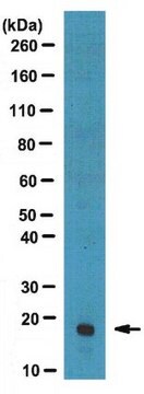 Anti-MFAP-5 (MAGP2) Antibody from rabbit, purified by affinity chromatography