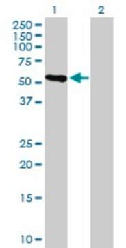 Anti-CRTAC1 antibody produced in mouse purified immunoglobulin, buffered aqueous solution