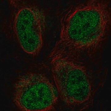 Anti-ZBTB47 antibody produced in rabbit Prestige Antibodies&#174; Powered by Atlas Antibodies, affinity isolated antibody