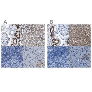 Anti-AMACR antibody produced in rabbit affinity isolated antibody, buffered aqueous glycerol solution