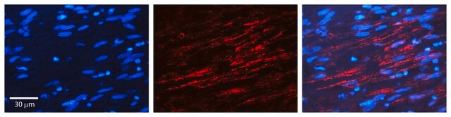 Anti-INSR antibody produced in rabbit affinity isolated antibody