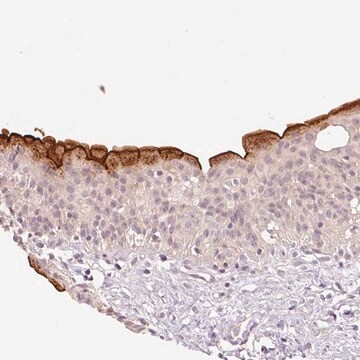 Anti-SLC29A3 antibody produced in rabbit Prestige Antibodies&#174; Powered by Atlas Antibodies, affinity isolated antibody, buffered aqueous glycerol solution