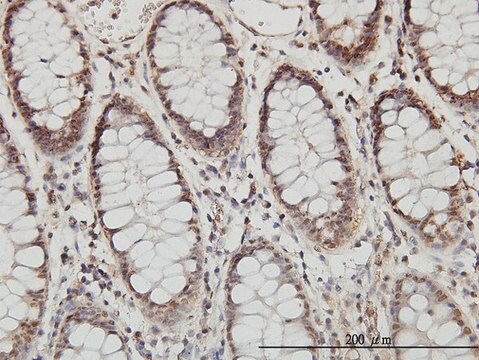 Monoclonal Anti-PSMB8 antibody produced in mouse clone 1B3, purified immunoglobulin, buffered aqueous solution