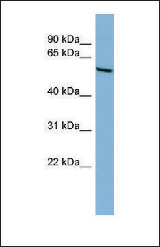 Anti-CYP2C18, (N-terminal) antibody produced in rabbit affinity isolated antibody