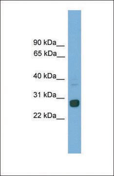 Anti-Mxd1 antibody produced in rabbit affinity isolated antibody