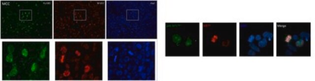 Anti-phospho 4E-BP1 (Ser83) serum, from rabbit