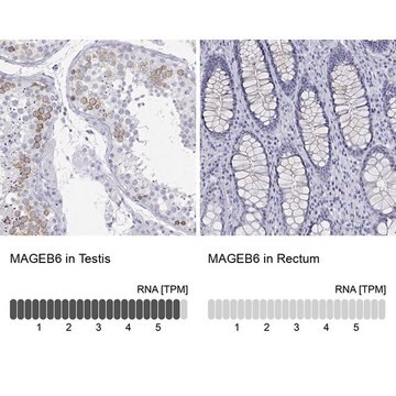 Anti-MAGEB6 antibody produced in rabbit Prestige Antibodies&#174; Powered by Atlas Antibodies, affinity isolated antibody, buffered aqueous glycerol solution