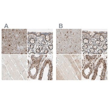 Anti-ARMC10 antibody produced in rabbit Ab2, Prestige Antibodies&#174; Powered by Atlas Antibodies, affinity isolated antibody, buffered aqueous glycerol solution