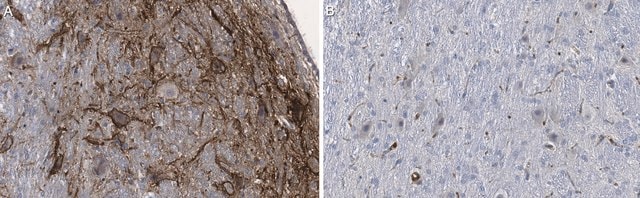 Anti-Aggrecan Core Protein Antibody, clone Cat-315