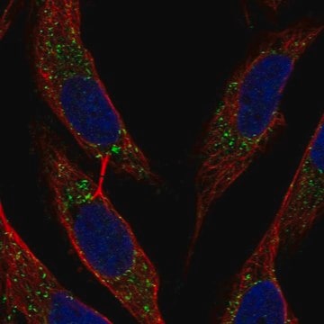 Anti-Bst2 Antibody Produced In Rabbit Prestige Antibodies&#174; Powered by Atlas Antibodies, affinity isolated antibody, buffered aqueous glycerol solution