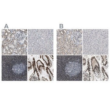 Anti-SP100 antibody produced in rabbit Prestige Antibodies&#174; Powered by Atlas Antibodies, affinity isolated antibody, buffered aqueous glycerol solution