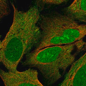 Anti-PYM1 antibody produced in rabbit Prestige Antibodies&#174; Powered by Atlas Antibodies, affinity isolated antibody