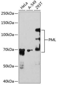 Anti-PML Antibody, clone 2A0N10, Rabbit Monoclonal