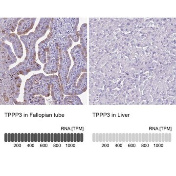 Anti-TPPP3 antibody produced in rabbit Prestige Antibodies&#174; Powered by Atlas Antibodies, affinity isolated antibody, buffered aqueous glycerol solution