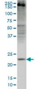 Monoclonal Anti-CRYGD antibody produced in mouse clone 4E12, purified immunoglobulin, buffered aqueous solution