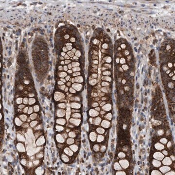 Anti-ALPK2 antibody produced in rabbit Prestige Antibodies&#174; Powered by Atlas Antibodies, affinity isolated antibody, buffered aqueous glycerol solution, ab4