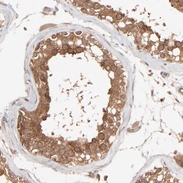 Anti-SCFD1 antibody produced in rabbit affinity isolated antibody, buffered aqueous glycerol solution