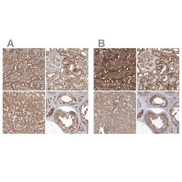 Anti-TRAIP antibody produced in rabbit Prestige Antibodies&#174; Powered by Atlas Antibodies, affinity isolated antibody, buffered aqueous glycerol solution