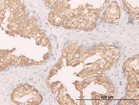 Monoclonal Anti-DCXR antibody produced in mouse clone 6A6, purified immunoglobulin, buffered aqueous solution