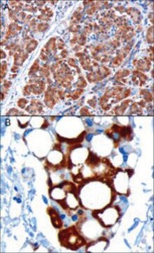 Anti-Pyruvate Dehydrogenase/PDHX antibody produced in goat affinity isolated antibody, buffered aqueous solution