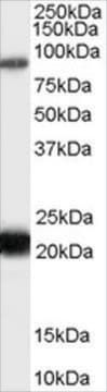 Anti-RASAL antibody produced in goat affinity isolated antibody, buffered aqueous solution