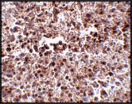 Anti-METTL7B (ab2) antibody produced in rabbit affinity isolated antibody, buffered aqueous solution