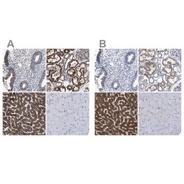 Anti-AASS antibody produced in rabbit Prestige Antibodies&#174; Powered by Atlas Antibodies, affinity isolated antibody, buffered aqueous glycerol solution, Ab2