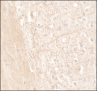 Anti-ERAP1 antibody produced in rabbit affinity isolated antibody