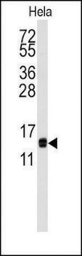 Anti-CDA (center) antibody produced in rabbit saturated ammonium sulfate (SAS) precipitated, buffered aqueous solution