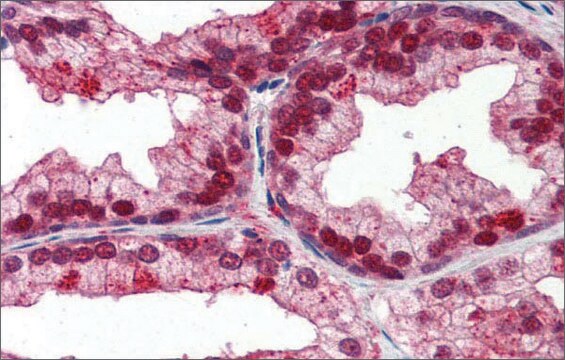 Anti-NFIX antibody produced in rabbit affinity isolated antibody