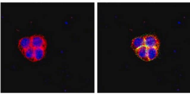 RIPAb+ Fragile X Mental Retardation Protein - RIP Validated Antibody and Primer Set from mouse