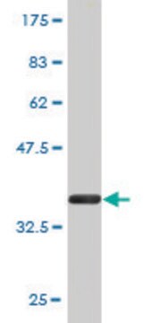 Monoclonal Anti-NAGLU antibody produced in mouse clone 1B7, purified immunoglobulin, buffered aqueous solution