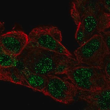 Anti-RCBTB1 antibody produced in rabbit Prestige Antibodies&#174; Powered by Atlas Antibodies, affinity isolated antibody